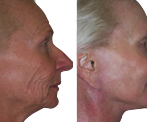 936e591c-c046-416b-9e71-887260b094d5